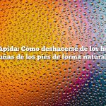 Respuesta rápida: Cómo deshacerse de los hongos en las uñas de los pies de forma natural